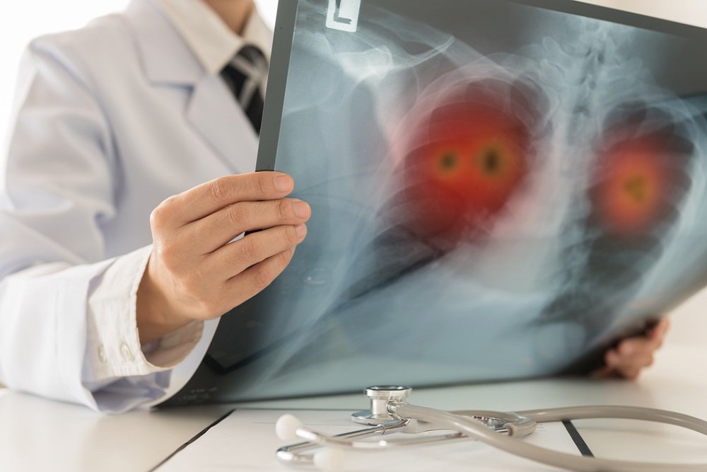 lung-diseases-img-01